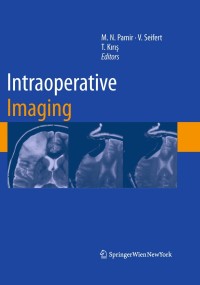 صورة الغلاف: Intraoperative Imaging 1st edition 9783211996508
