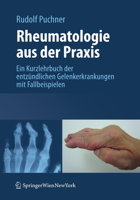 Rheumatologie aus der Praxis : Kurzlehrbuch der entzündlichen Gelenkerkrankungen mit Fallbeispielen - FULL INSTANT DOWNLOAD | PDF DOCX EPUB
