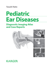 صورة الغلاف: Pediatric Ear Diseases 9783318022322