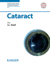 Cover image: Cataract 9783318024104