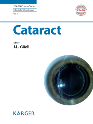 Cover image: Cataract 1st edition 9783318024104