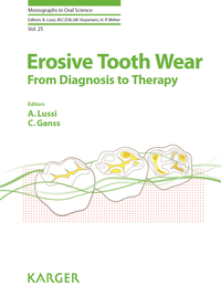 Cover image: Erosive Tooth Wear 9783318025521