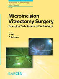 Immagine di copertina: Microincision Vitrectomy Surgery 9783318026603