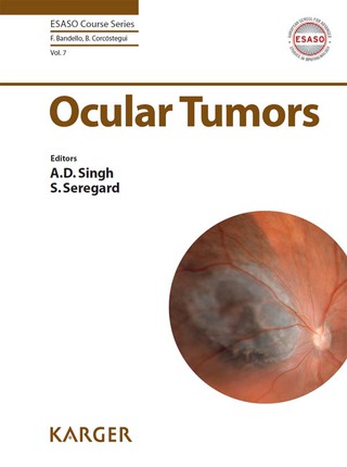 Cover image: Ocular Tumors 1st edition 9783318056181