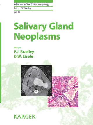 Imagen de portada: Salivary Gland Neoplasms 1st edition 9783318058017