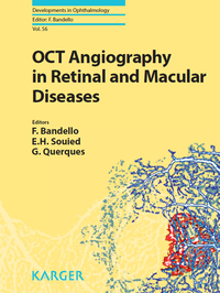 表紙画像: OCT Angiography in Retinal and Macular Diseases 9783318058291