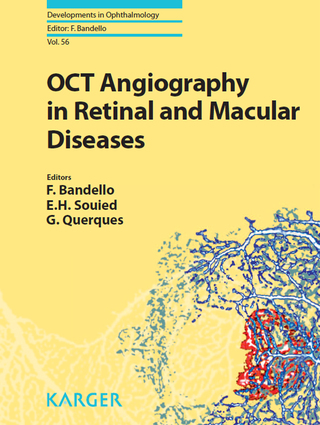 Cover image: OCT Angiography in Retinal and Macular Diseases 1st edition 9783318058291