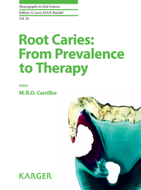 صورة الغلاف: Root Caries: From Prevalence to Therapy 9783318061123