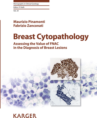 Cover image: Breast Cytopathology 1st edition 9783318061406