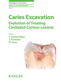 صورة الغلاف: Caries Excavation: Evolution of Treating Cavitated Carious Lesions 9783318063684