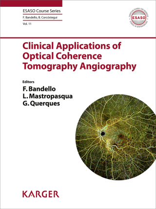 Cover image: Clinical Applications of Optical Coherence Tomography Angiography 1st edition 9783318066432