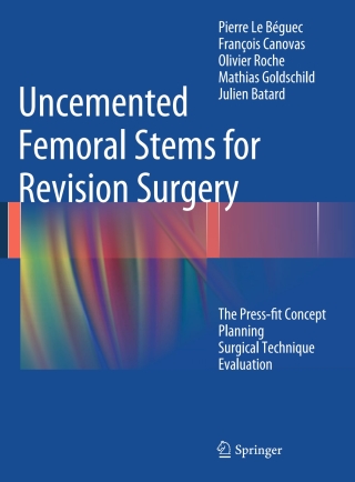 صورة الغلاف: Uncemented Femoral Stems for Revision Surgery 9783319036137