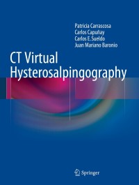 Titelbild: CT Virtual Hysterosalpingography 9783319075594