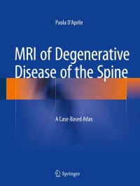 Cover image: MRI of Degenerative Disease of the Spine 9783319094465