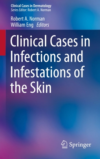 صورة الغلاف: Clinical Cases in Infections and Infestations of the Skin 9783319142944