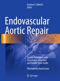 صورة الغلاف: Endovascular Aortic Repair 9783319151915