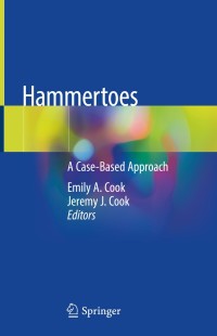 Cover image: Hammertoes 9783319165516