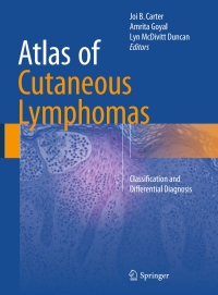 Imagen de portada: Atlas of Cutaneous Lymphomas 9783319172163