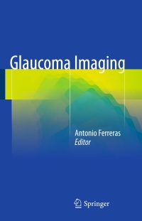 Titelbild: Glaucoma Imaging 9783319189581