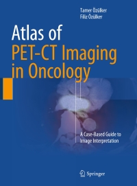 表紙画像: Atlas of PET-CT Imaging in Oncology 9783319189932