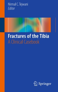 Cover image: Fractures of the Tibia 9783319217734