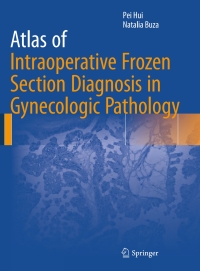 Cover image: Atlas of Intraoperative Frozen Section Diagnosis in Gynecologic Pathology 9783319218069