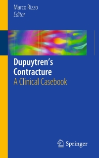 Cover image: Dupuytren’s Contracture 9783319238401