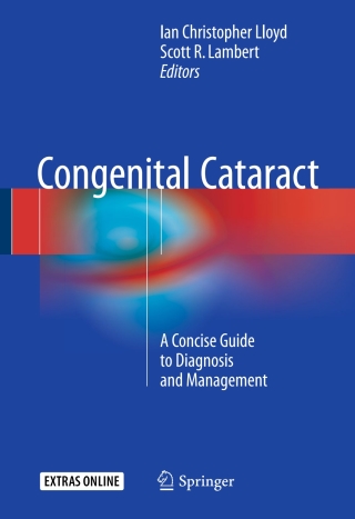 Omslagafbeelding: Congenital Cataract 9783319278469