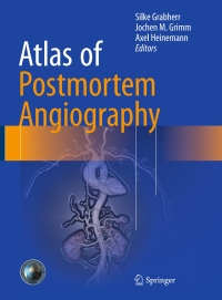 Titelbild: Atlas of Postmortem Angiography 9783319285351