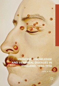 Cover image: Medicine, Knowledge and Venereal Diseases in England, 1886-1916 9783319324548