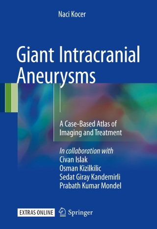 Omslagafbeelding: Giant Intracranial Aneurysms 9783319417868