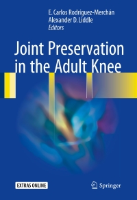 Imagen de portada: Joint Preservation in the Adult Knee 9783319418070