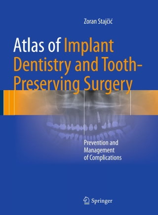 Cover image: Atlas of Implant Dentistry and Tooth-Preserving Surgery 9783319421223