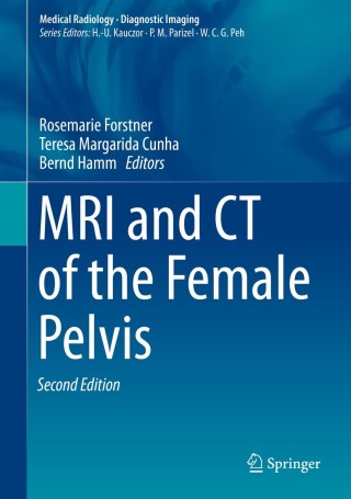Cover image: MRI and CT of the Female Pelvis 2nd edition 9783319425733