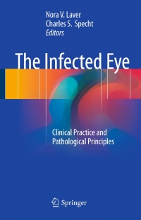 Cover image: The Infected Eye 9783319428383