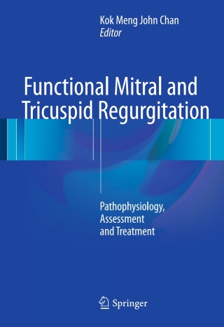 Cover image: Functional Mitral and Tricuspid Regurgitation 9783319435084