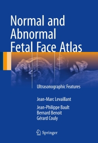 表紙画像: Normal and Abnormal Fetal Face Atlas 9783319437682