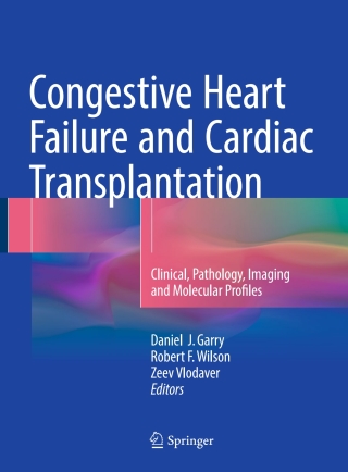 Cover image: Congestive Heart Failure and Cardiac Transplantation 9783319445755