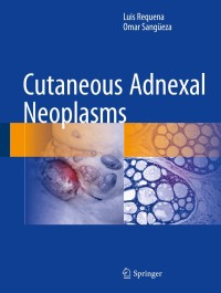 Omslagafbeelding: Cutaneous Adnexal Neoplasms 9783319457031