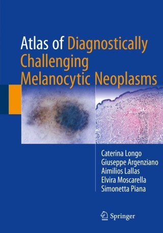 Imagen de portada: Atlas of Diagnostically Challenging Melanocytic Neoplasms 9783319486512