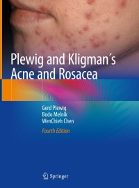 Titelbild: Plewig and Kligman´s Acne and Rosacea 4th edition 9783319492735