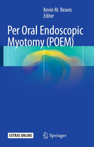 صورة الغلاف: Per Oral Endoscopic Myotomy (POEM) 9783319500492