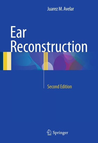 Cover image: Ear Reconstruction 2nd edition 9783319503936