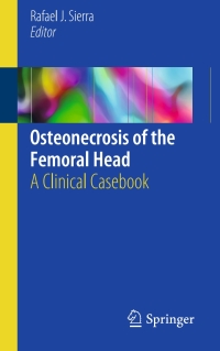 表紙画像: Osteonecrosis of the Femoral Head 9783319506623