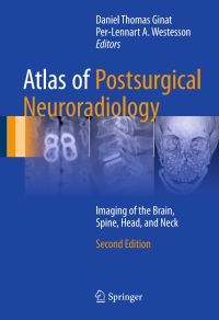Imagen de portada: Atlas of Postsurgical Neuroradiology 2nd edition 9783319523408