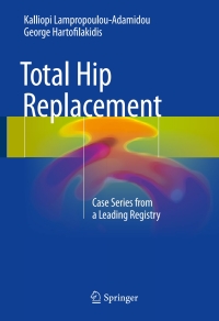 Imagen de portada: Total Hip Replacement 9783319533599