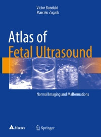 Titelbild: Atlas of Fetal Ultrasound 9783319547978