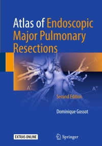 Cover image: Atlas of Endoscopic Major Pulmonary Resections 2nd edition 9783319559001