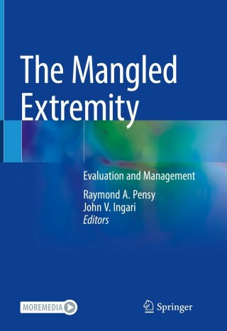 Immagine di copertina: The Mangled Extremity 9783319566474