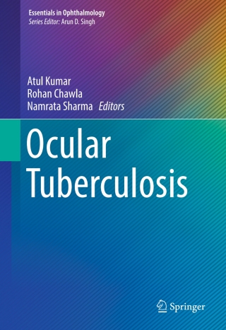 Immagine di copertina: Ocular Tuberculosis 9783319575193
